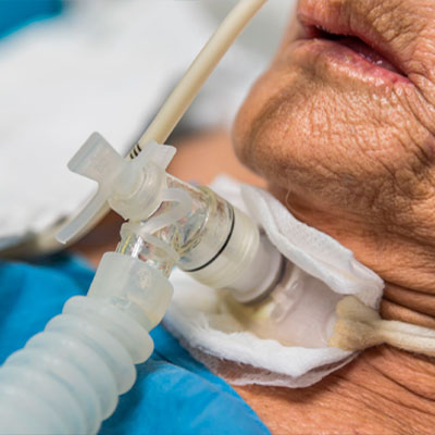 Material gratuito (DOPE) Traqueostomia/Sondas